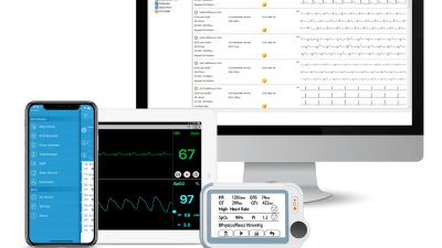 AliveCor KardiaCard Reviewing the Best Credit-Card Sized Personal EKG Monitor