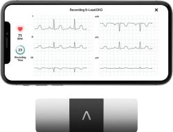 KardiaMobile 6L Evaluating the Best FDA-Cleared Portable EKG Device Performance