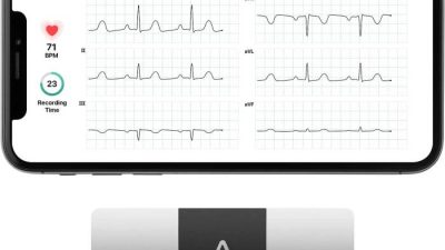 KardiaMobile 6L Evaluating the Best FDA-Cleared Portable EKG Device Performance